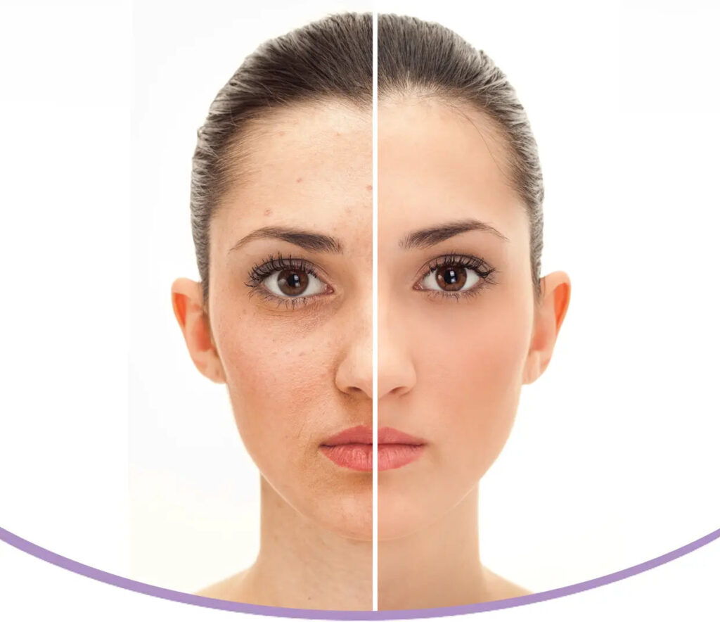 anti-aging-banner
