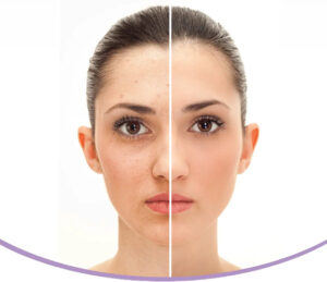 anti-aging-banner