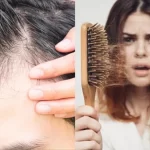 बरसात में बाल झड़ने से हैं परेशान? काम आएंगे डर्मेटोलॉजिस्ट के बताए ये तरीके…